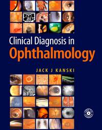 Clinical Diagnosis in Ophthalmology