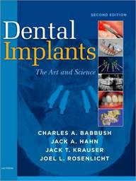 Dental Implants: The Art and Science, 2nd Edition
