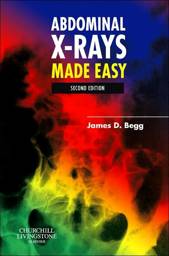 Abdominal X-Rays Made Easy, 2nd Edition, International Edition