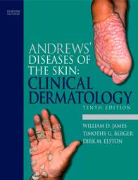 Andrews' Diseases of the Skin: Clinical Dermatology, International Edition, 10th Edition