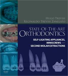 State-of-the-Art Orthodontics: Self-Ligating Appliances, Miniscrews and Second Molars Extraction