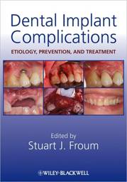 Dental Implant Complications: Etiology, Prevention, and Treatment